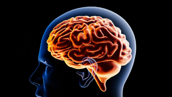 Image of the brain